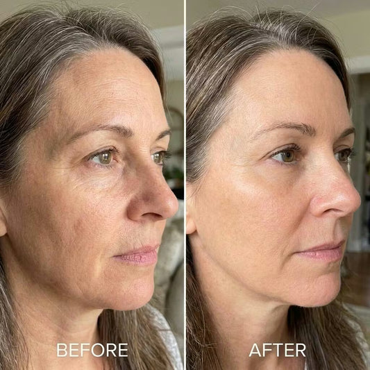 Before and after comparison of a woman's face with visible skin texture differences.