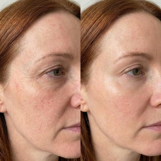 Before and after comparison of a woman's face with visible skin texture differences.